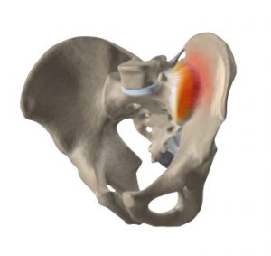 Si Joint | Pelvis and Hips